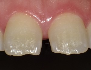 SHOFU DENTAL DIGITAL CAMERA