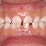 %e7%99%92%e5%90%88%e6%ad%af